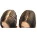100% Natural Keratin Hair Fibre Refill for Hair Loss - Alopecia & Chemotherapy in Dark Blonde (50g) - Buy Online on GoSupps.com