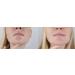 Su-Skin Face Moisturizer - Rejuva Gel for Dry Skin with Vitamin E & Glycerin - Hydrating Dermal Repair - Buy Online on GoSupps.com