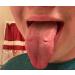 RPE Tongue Guard - Prevents and Heals Tongue Sores from Dental Expanders - Buy Online on GoSupps.com