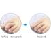 Buy Silicone Toe Clips & Separators | Soft Gel Spacers for Hammer Toes Overlapping & Splinter Relief - International Shipping Available - Buy Online on GoSupps.com