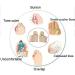 Buy Bunion Corrector - Pain Relief Hallux Valgus Bunion Socks & Orthopedic Gel Splint for Men & Women | Shop Internationally - Buy Online on GoSupps.com