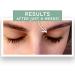 Park Perfection Lash Enhancing Serum - Longer Thicker Eyelashes | Dermatologist-Developed | Cruelty-Free | 3.5 mL - Buy Online on GoSupps.com