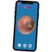Buy Ear View MD Wi-Fi Ear Camera Professional Ear Cleaning & Health Monitoring Tool for Home Use | Fast International Shipping - Buy Online on GoSupps.com