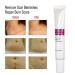 Scar Removal Cream | Anti-Scar Gel for Old Scars, Stretch Marks & Burned Skin Repair - Buy Online on GoSupps.com