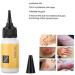Scar Treatment Serum 20ml - Acne Scar Removal Cream for Smooth & Rejuvenated Skin - Buy Online on GoSupps.com