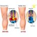 KEKING Thigh High Compression Stockings - Footless Unisex 20-30mmHg Leg Support Sleeve for Swelling Varicose Veins & Edema - Anti-Slip Silicone Band - Black 5X-Large - Buy Online on GoSupps.com