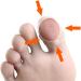 Ingrown Toenail Corrector Sleeves 4 Pairs Elastic Silicone Ingrown Toenail Correction Tool Thick Paronychia Treatment Corrector Big Toe Sleeves Toe Nail Healing Care Protector for Keep Nail Healthy - Buy Online on GoSupps.com