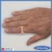 ArthroEze Oval Trigger Finger Splint Peach - Size 10.5 (63.5mm CIRC) - Buy Online on GoSupps.com