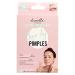 TEA TREE + SALICYLIC ACID BYE-bye PIMPLES