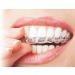 Yishang Custom Transparent Orthodontic Retainer - Buy Online on GoSupps.com