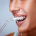 ToothShower Orthodontic Brush Suite Accessory - Replacement Toothbrush Heads and Water Pick Accessories for Oral Irrigator - Blue Teeth Cleaning Tool - Buy Online on GoSupps.com
