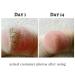 Foot Repair Serum Treatment for Dry, Cracked Heels, Eczema & Rough Feet - Moisturizing Lotion for Calluses - Dead Skin Remover - Anti-Drying Formula - Buy Online on GoSupps.com