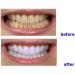 Professional Portable Teeth Whitening Machine with LED Accelerator Light - YS-TW-A - Buy Online on GoSupps.com