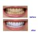 NSKI LED Teeth Whitening Light Accelerator Lamp 6000mw/c YS-TW-A - US Stock by East Dental - Buy Online on GoSupps.com