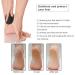 Vridale Pumice Stone for Feet - Callus Removal Foot Scrubber for Exfoliation - Hand & Foot Care - Buy Online on GoSupps.com