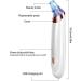 FEDRUI Blackhead Remover Pore Cleaner Blackheads Pore Sucker with 5 Suction Heads Acne Comedone Extractor Kit Blackhead Removal Tool for Beauty Salon (Color : White) - Buy Online on GoSupps.com