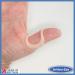 ArthroEze Oval Peach Thumb Splint for Trigger Thumb, Mallet Thumb, Hypermobility, Arthritis - Size 8 (56.9mm Circ) - Buy Online on GoSupps.com