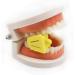 Dental Mund Bite Blocks - 3-Piece Occlusal Pad Set for Dentists | Teeth Prop & Rubber Opener Tools | International Shipping Available - Buy Online on GoSupps.com