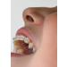 APA CARE Mineralizing Tooth Lacquer with 20% Hydroxylapatite | Self-Curing Schellack-Based Liquid Tooth Enamel | 5ml Brush Bottle - International Shipping Available - Buy Online on GoSupps.com