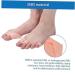 Allesoky Bunion Corrector Toe Alignment Tool - 5 Pairs | Soft Gel Separators for Foot Pain Relief, Toe Straightener Pads & Forefoot Support - Buy Online on GoSupps.com