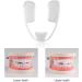 Buy Bite Rail for Teeth Grinding - Protect Teeth Gums & Jaws | Includes Storage Box - Buy Online on GoSupps.com