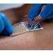Large Hydrocolloid Dressing 20x20cm x 5 - Fast Healing Wound Care - Buy Online on GoSupps.com