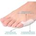 Pedimend Silicone Gel Little Foot Football - 3 Pairs | Toe Protection Sleeves & Foot Care Massage Device - Buy Online on GoSupps.com