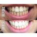 Smile Sciences Teeth Whitening Ultra Red & Blue LED Light - Effective International Shipping Available - Buy Online on GoSupps.com