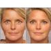 Retinol Gel 0.1 Vitamin A Repairs Fine Lines & Wrinkles Scar Treatment Age and Sun Spots Anti-Aging Formula 20 Grams (Ret_0.1) - Buy Online on GoSupps.com