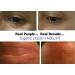 Raw Biology Organic Liquid Facelift with Vitamin C, Retinol & Hyaluronic Acid 1 Fl Oz (Pack of 3) - Buy Online on GoSupps.com