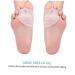 Ducalmoral Bunion Corrector & Gel Toe Straightener with Forefoot Pads - Silicone Toe Separators for Foot Pain Relief | Ballet & Athletic Accessories - Buy Online on GoSupps.com