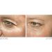 Look 10 Years Younger Instantly with Genesphere | Lift Wrinkles in Minutes - Shop Now - Buy Online on GoSupps.com