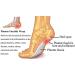 Feegow Plantar Fasciitis Relief Compression Cuffs | Foot Care Inserts & Support for Pain Relief - Buy Online on GoSupps.com