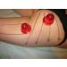 Boolavard 2X Silicone Massage Cupping Anti-Cellulite Cups - Beauty Therapy Essential - Buy Online on GoSupps.com
