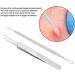 Blackhead & Pimple Removal Tool Stainless Steel Blackhead Removal Tool Kit Curved Tweezers+Looped Double-end Pimple Extractor - Buy Online on GoSupps.com