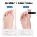 Bale Toe - Hallux Valgus Big Toe Stretcher & Separator | Restore Alignment of Overlapping & Curved Toes | Shop Internationally - Buy Online on GoSupps.com