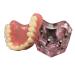 Vinbcorw Dental Modell -Maxilla Mini 4 Implant screws -Mobile prosthesis Repair of medical patient communication removable pink pink