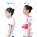Back Posture Corrector Therapy Corset Spine Support Belt Lumbar Back Posture Correction Bandage for Men Women Adult Children (Color : Pink) Handmade Full moon lofty ambition - Buy Online on GoSupps.com