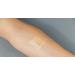 Clozex Wound Closure Device - FDA Cleared Laceration Repair Without Stitches - 3 Sizes for International Shipping - Buy Online on GoSupps.com