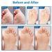 Buy Mymulike 48PC Chicken Pots - Effective Corn Removal Pads for Foot Care & Chicken Symptoms - Buy Online on GoSupps.com