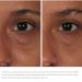 IMAGE Skincare ORMEDIC Balancing Eye Lift Gel - Revitalize and Brighten Your Eyes - Buy Online on GoSupps.com