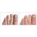 Maximum Strength Anti-Fungal Nail Medication Gel with Tolnaftate - Doctor-Approved Treatment for Nail Fungus & Yellow Nails - Easy-to-Use & Restores Nail Health - Buy Online on GoSupps.com