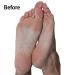 Emjoi Micro-Pedi Nano Pro Callus Remover - Smooth, Soft Feet in Seconds - Buy Online on GoSupps.com