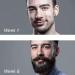 Beard Growth Roller for Men - 540 0.5MM Titanium Microneedle Roller - Buy Online on GoSupps.com