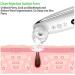FEDRUI HD Visual Electric Blackhead Absorber USB Rechargeable Blackheads Suction Device 6 Gears Blackhead Remover with Microscope for Facial Deep Cleansing - Buy Online on GoSupps.com