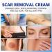 Scar Removal Cream for Old & New Scars - Skin Repair Gel for Surgical, Acne & C-Section Marks - Buy Online on GoSupps.com