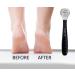 FACN Professional Pedicure Callus Shaver Remover - 50 Blades Included - Surgical Grade Stainless Steel - Salon Quality Tool for Removing Calluses, Corns & Rough Skin - Buy Online on GoSupps.com