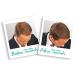 Hair Building Fibres for Thinning Hair (Auburn) - Buy Online on GoSupps.com