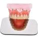 5 Piece Intraoral Mirror Set - Professional Orthodontic Photography | Dual-Sided Reflector for Clinical Dentists | High-Quality Dental Occlusal Mirrors - Buy Online on GoSupps.com