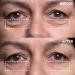 Wrinkles Schminkles Eye & Mouth Lift Set | Reusable Silicone Patches for Mouth & Lip Wrinkles (2-Pack) & Eye Wrinkles (3-Pairs) - Shop Internationally - Buy Online on GoSupps.com